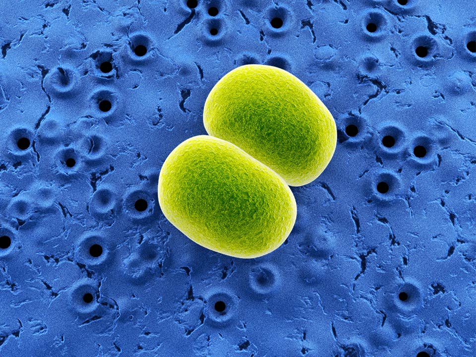 Mikroskopische Aufnahme der Staphylococcus Epidermidis Bakterien auf der Haut